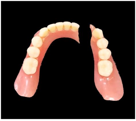 dentures urlebird|Dentures .